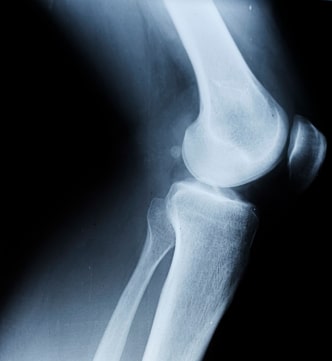 Strong Bones Need More Than Calcium to Stay Healthy