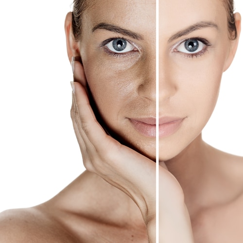 Can Exercise Benefit Your Skin and Slow Skin Aging?