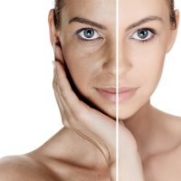 Aging Skin: Understanding Two Types of Skin Aging