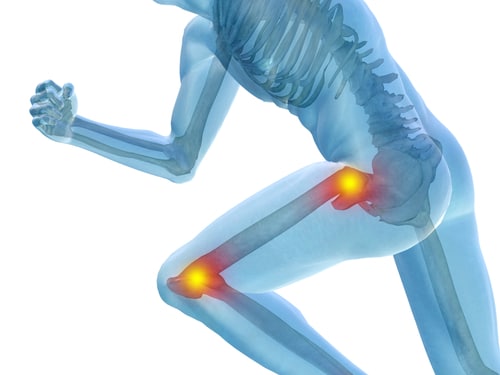 Exercise and Joint Health: Can Working Out Make Achy Joints Feel Better?