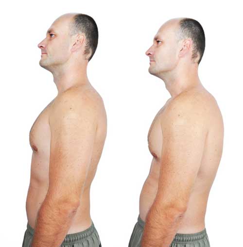 Problems Caused by Rounded Shoulders and How to Correct Them