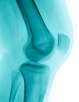 Healthy cartilage and joints are often overlooked until the first signs of osteoarthritis appear. This article looks at the importance of keeping your cartilage healthy and how to do it, so you can enjoy many years of pain-free activities.