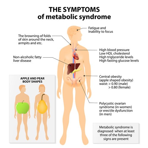 How to Lower Your Risk of Metabolic Syndrome