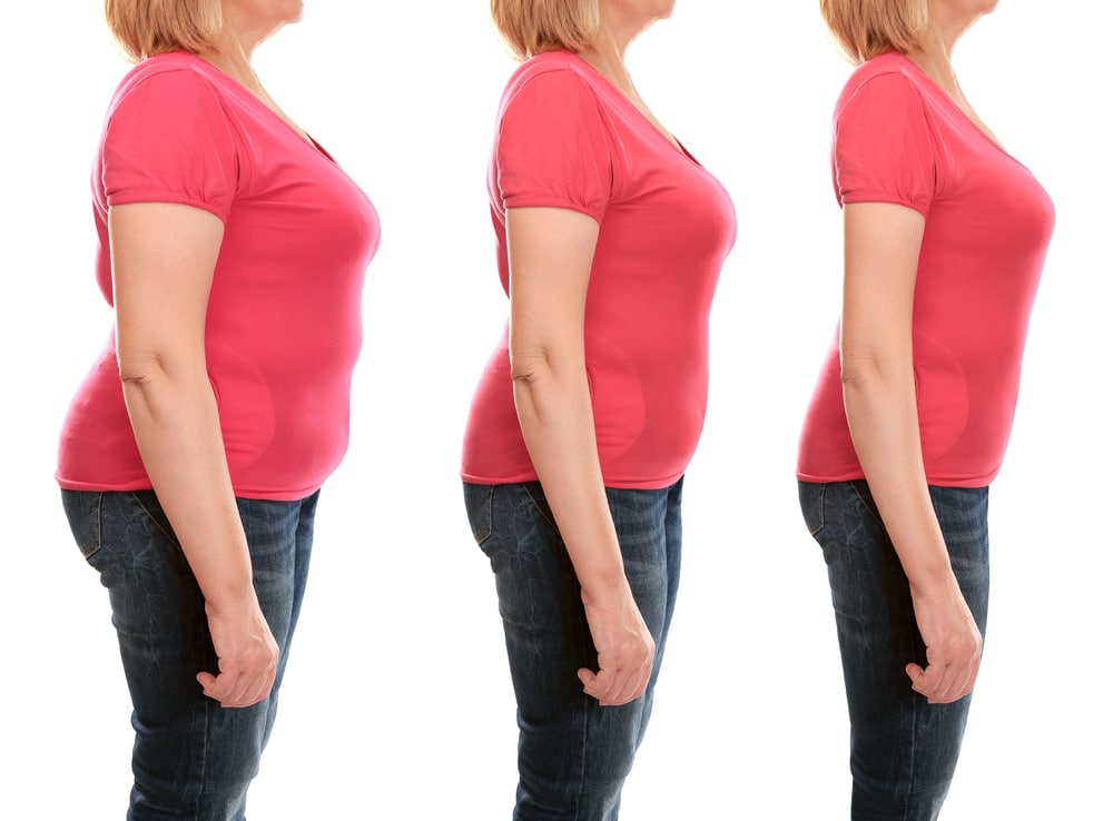 Three pictures of a woman's side view taken over time showing her weight loss . How Much weight loss do you have to have to improve your health? You Might Be Surprised!