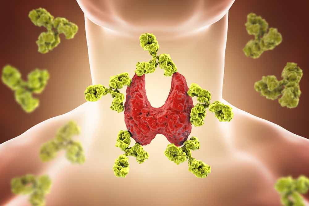 image of a thyroid under attack. What factors determine thyoid health?