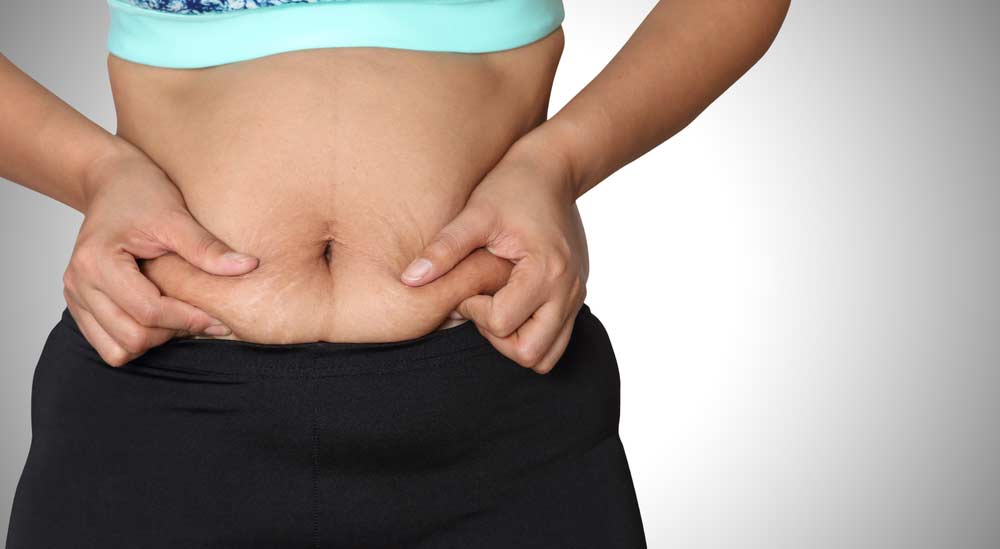 image of a woman pinching her fat storage around her waist