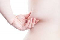 An overweight woman pinching her saggy skin