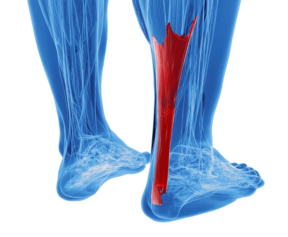 How to Strengthen Tendons and Ligaments With Strength Training