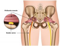 The Piriformis Muscle