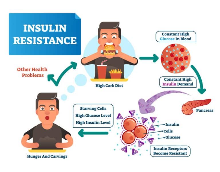 Insulin Resistance