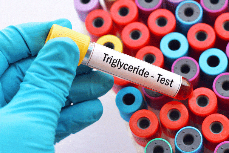 Triglyceride Levels