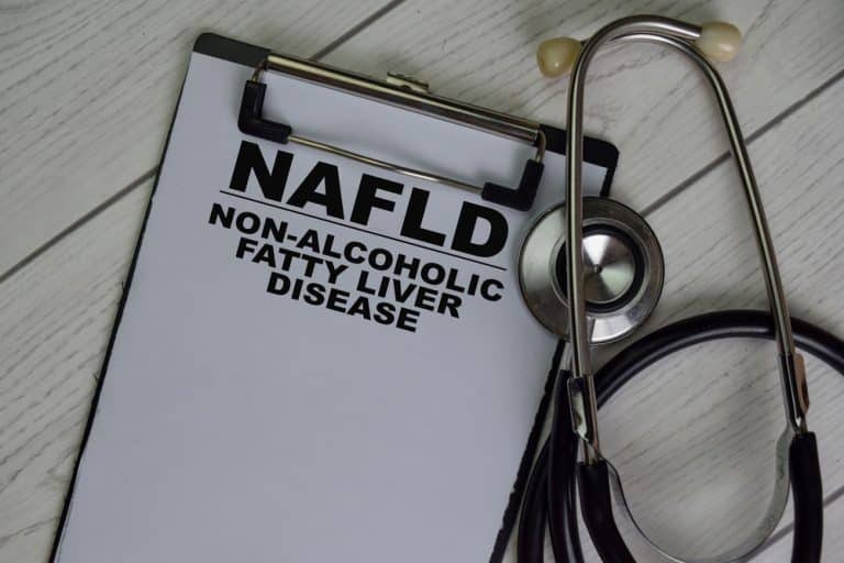 Non-Alcoholic Fatty Liver