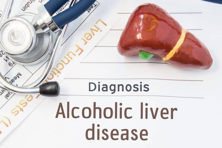 Non-Alcoholic Fatty Liver Disease