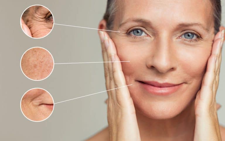 Skin Aging