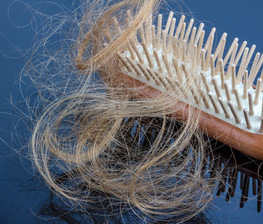 Thinning hair and hair loss